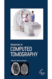 Advances in Computed Tomography