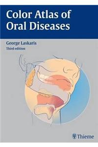 Color Atlas of Oral Diseases