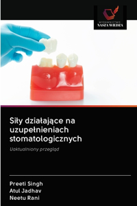 Sily dzialające na uzupelnieniach stomatologicznych