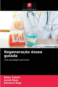 Regeneração óssea guiada