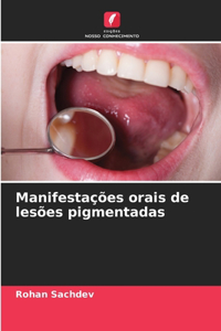 Manifestações orais de lesões pigmentadas