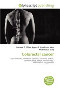 Colorectal Cancer
