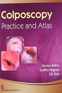 Colposcopy and Atlas