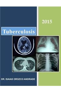 Tuberculosis 2015