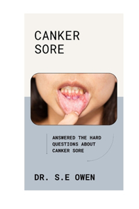 Canker Sore