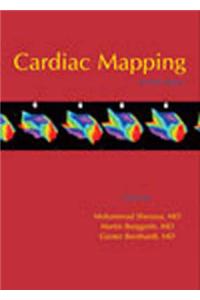 Cardiac Mapping