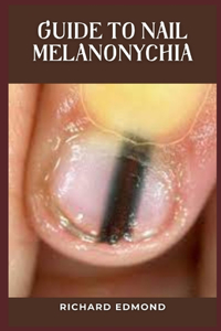 Guide to Nail Melanonychia