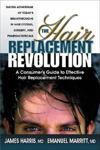 Hair Replacement Revolution: A Consumer's Guide to Effective Hair Replacement Techniques