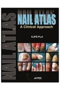 Nail Atlas: A Clinical Approach