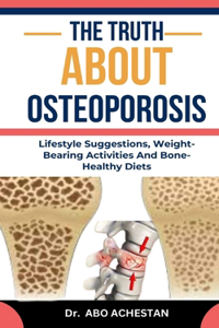 The Truth about Osteoporosis