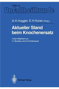 Aktueller Stand Beim Knochenersatz