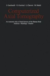 Computerized Axial Tomography