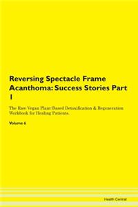Reversing Spectacle Frame Acanthoma
