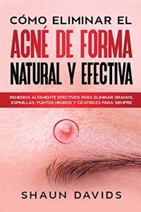 Cómo Eliminar el Acné de Forma Natural y Efectiva