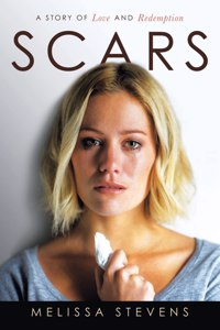 Scars