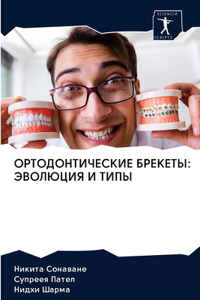 ОРТОДОНТИЧЕСКИЕ БРЕКЕТЫ