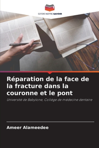 Réparation de la face de la fracture dans la couronne et le pont