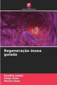 Regeneração óssea guiada