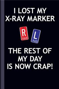 I Lost My X-Ray Marker the Rest of My Day Is Now Crap!
