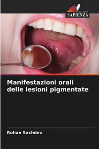 Manifestazioni orali delle lesioni pigmentate