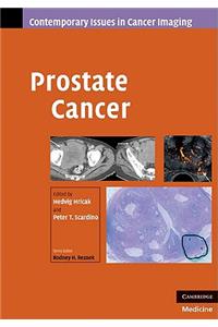 Prostate Cancer