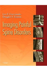 Imaging Painful Spine Disorders