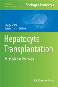 Hepatocyte Transplantation