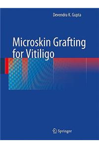 Microskin Grafting for Vitiligo