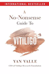 A No-Nonsense Guide To Vitiligo