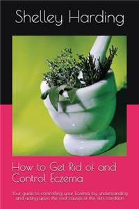 How to get Rid of and Control Eczema