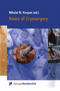 Basics of Cryosurgery