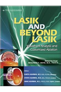 Lasik and Beyond Lasik English Edition: Wavefront Analysis and Customized Ablation