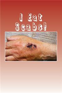 I Eat Scabs!