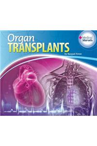 Organ Transplants