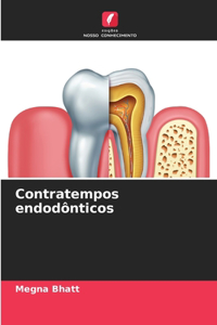 Contratempos endodônticos