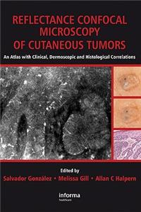 Reflectance Confocal Microscopy of Cutaneous Tumors