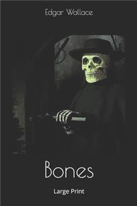 Bones