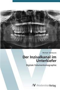 Der Inzisalkanal im Unterkiefer
