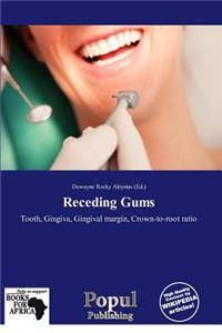 Receding Gums