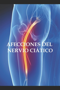 Afecciones del nervio ciático
