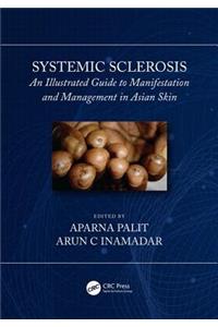 Systemic Sclerosis