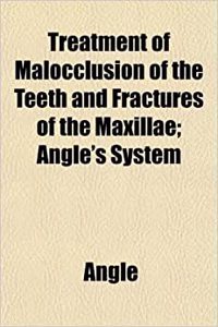 Treatment of Malocclusion of the Teeth and Fractures of the Maxillae; Angle's System