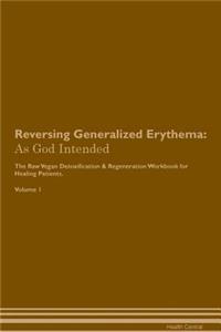 Reversing Generalized Erythema: As God Intended the Raw Vegan Plant-Based Detoxification & Regeneration Workbook for Healing Patients. Volume 1