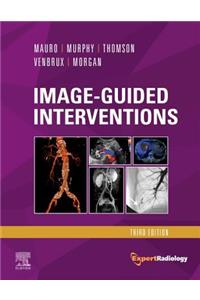 Image-Guided Interventions E-Book