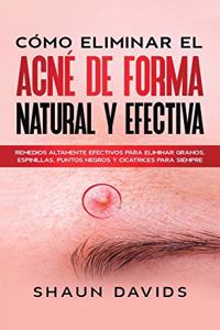 Cómo Eliminar el Acné de Forma Natural y Efectiva