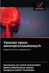 Tętniaki tętnic wewnątrzczaszkowych