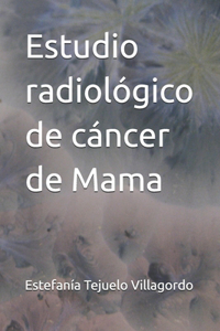 Estudio radiológico de cáncer de Mama