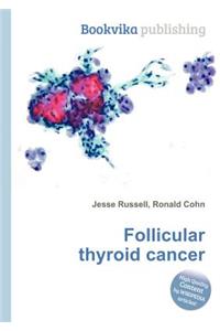 Follicular Thyroid Cancer