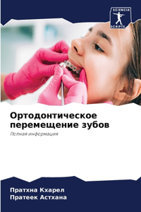 Ортодонтическое перемещение зубов