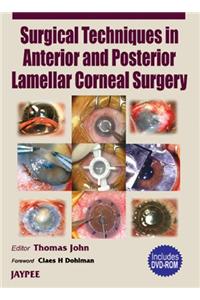 Surgical Techniques in Anterior and Posterior Lamellar Corneal Surgery